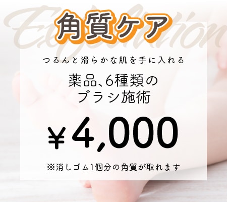 角質ケア　薬品、6種類のブラシ施術　4,000円　※消しゴム一個分の角質が取れます